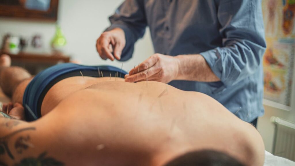 acupuntura